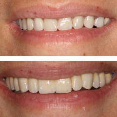 Missing many teeth 1