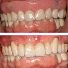 Missing many teeth 2