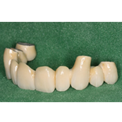 Missing many teeth 3