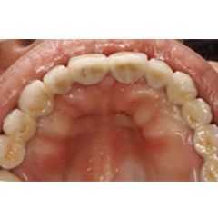 Missing many teeth 4