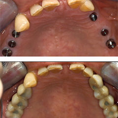 Missing many teeth 5