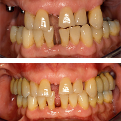 Missing many teeth 6