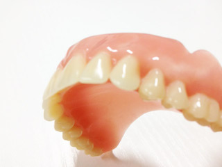 implant overdenture
