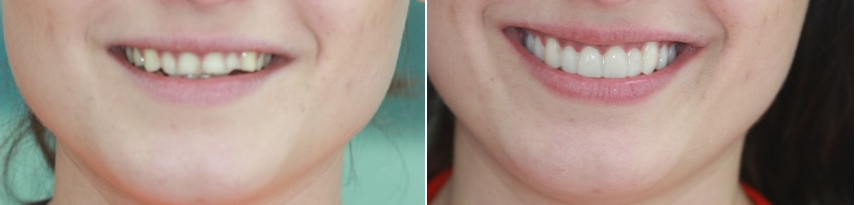 smile mockup