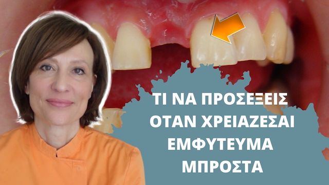 Μπροστινό εμφύτευμα, σημαντικές πληροφορίες 