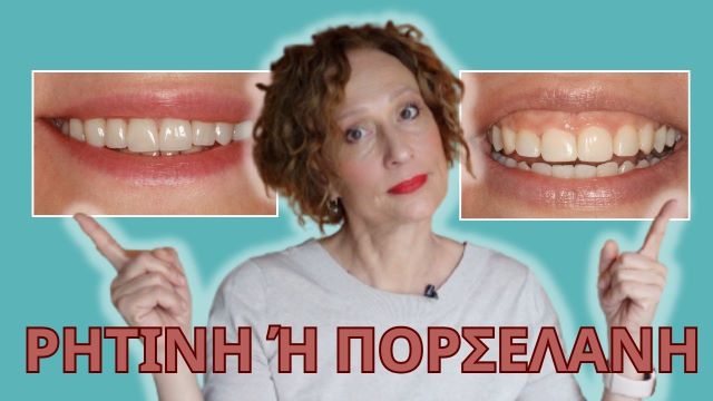 όψεις ρητίνης ή όψεις πορσελάνης