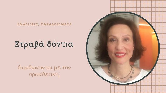 Στραβά δόντια