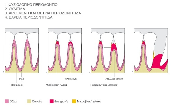 periodontist Ioannis Theodoropoulos