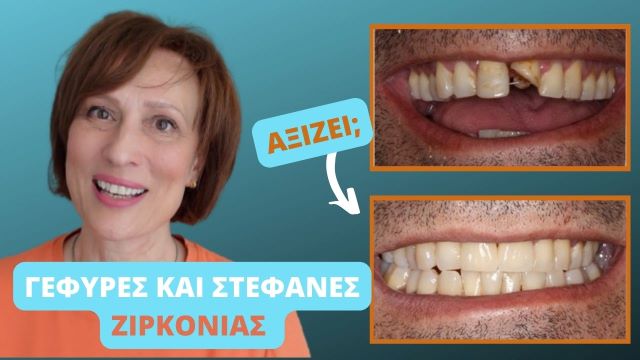 ζιρκόνιο 